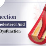 Cholesterol